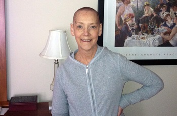 Barbara, NHL survivor,  after losing her hair during cancer treatment